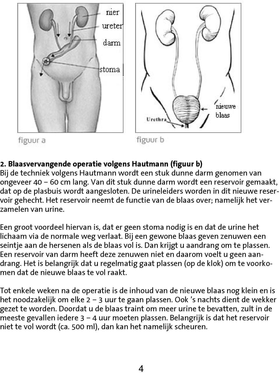 Het reservoir neemt de functie van de blaas over; namelijk het verzamelen van urine. Een groot voordeel hiervan is, dat er geen stoma nodig is en dat de urine het lichaam via de normale weg verlaat.