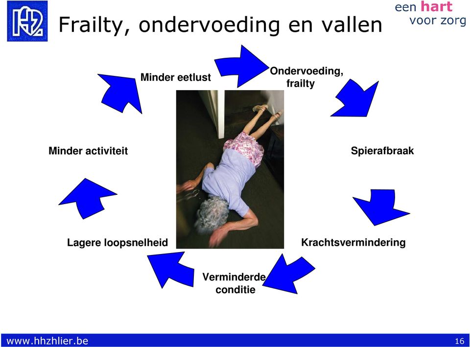 eetlust Ondervoeding, frailty Minder