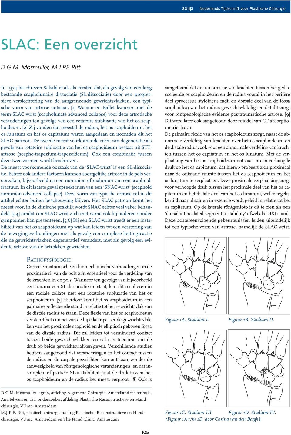 ontstaat. [1] Watson en Ballet kwamen met de term SLAC-wrist (scapholunate advanced collapse) voor deze artrotische veranderingen ten gevolge van een rotatoire subluxatie van het os scaphoideum.