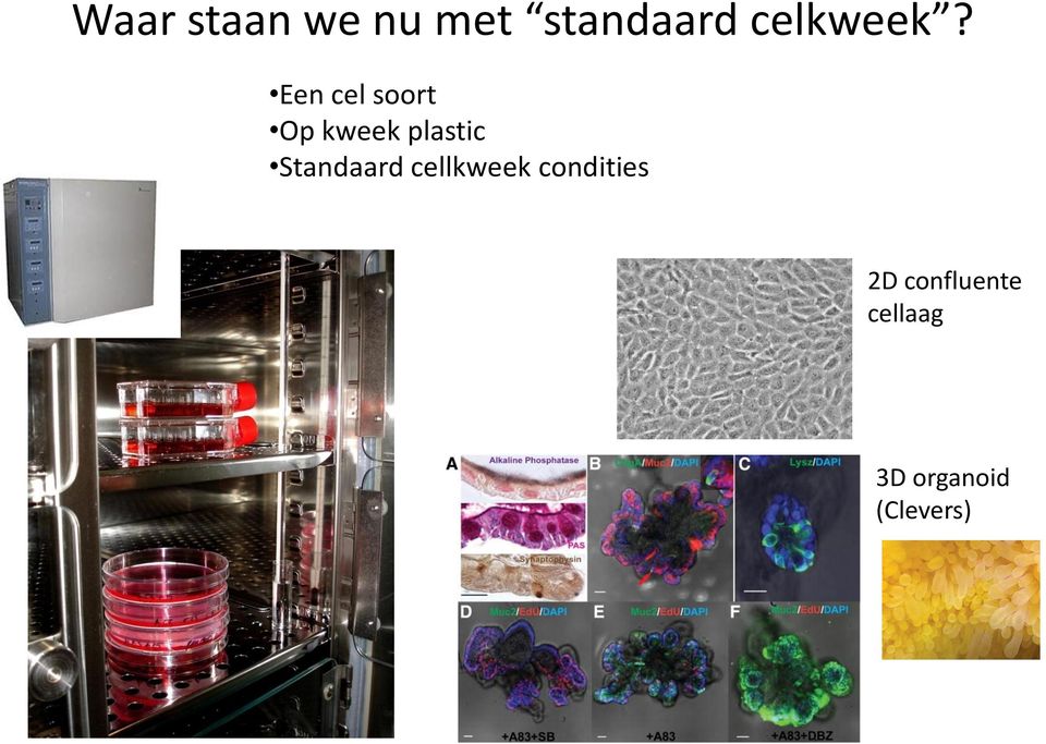 Een cel soort Op kweek plastic