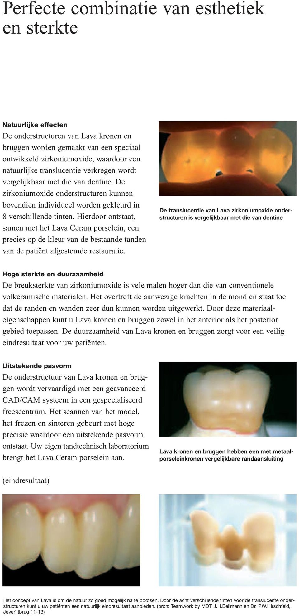 Hierdoor ontstaat, samen met het Lava Ceram porselein, een precies op de kleur van de bestaande tanden van de patiënt afgestemde restauratie.