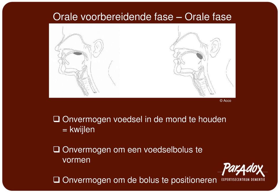 kwijlen Onvermogen om een voedselbolus te