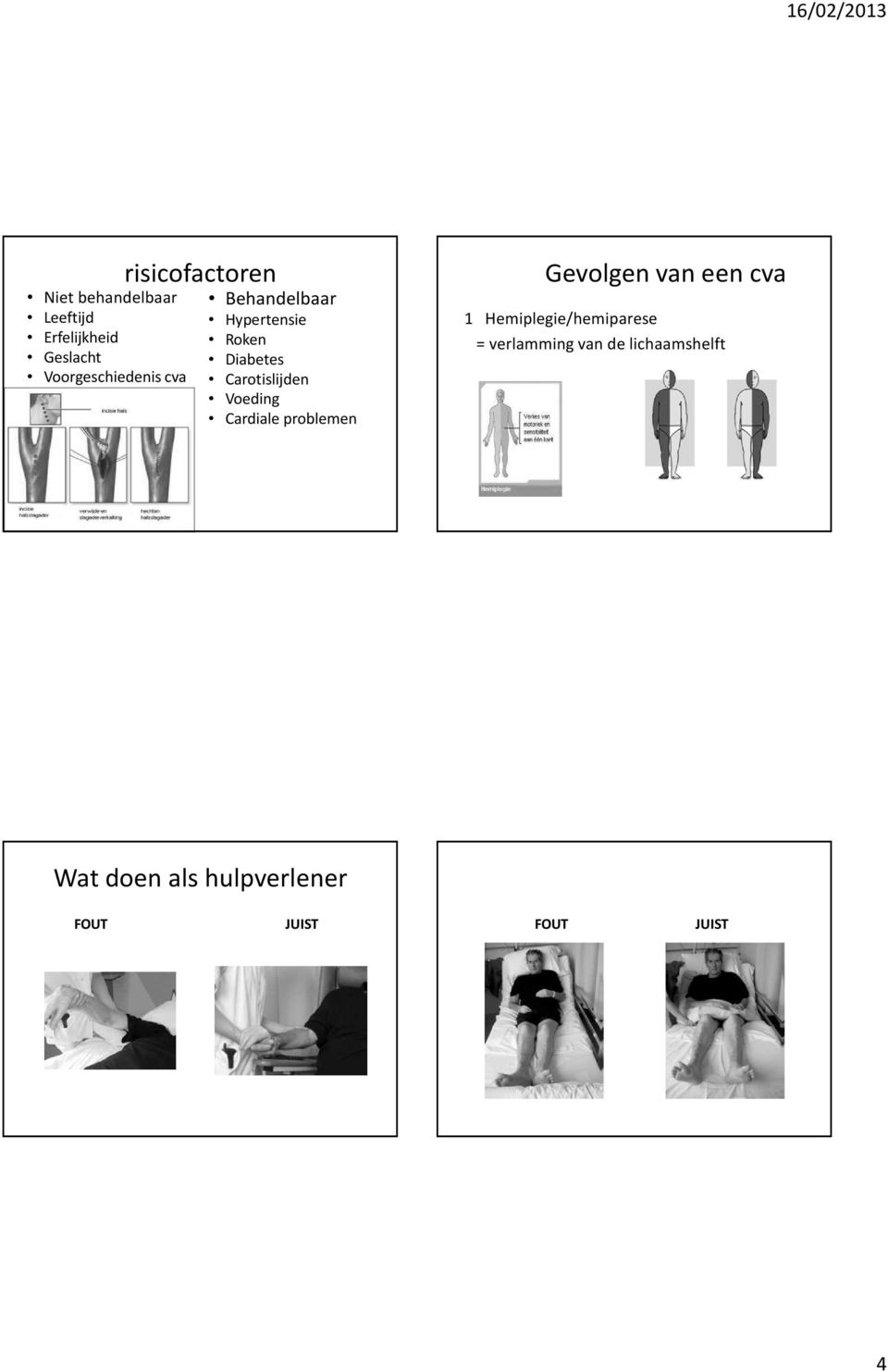 Voeding Cardiale problemen Gevolgen van een cva 1 Hemiplegie/hemiparese =