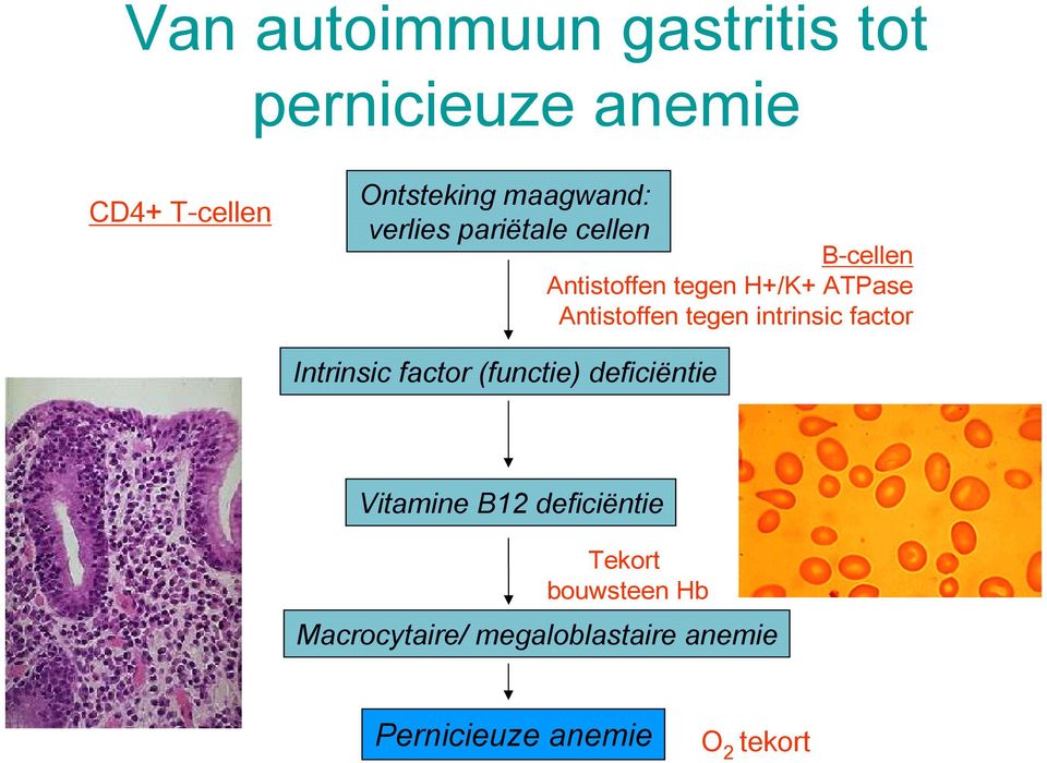 intrinsic factor Intrinsic factor (functie) deficiëntie Vitamine B2 deficiëntie