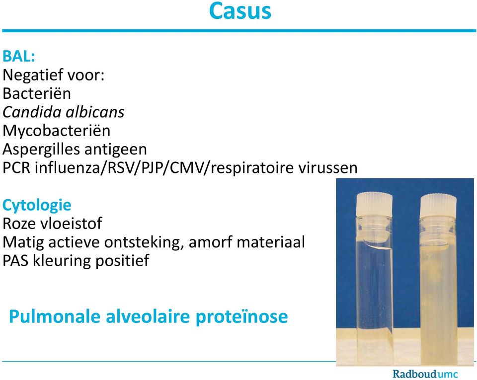 influenza/rsv/pjp/cmv/respiratoire virussen Cytologie Roze