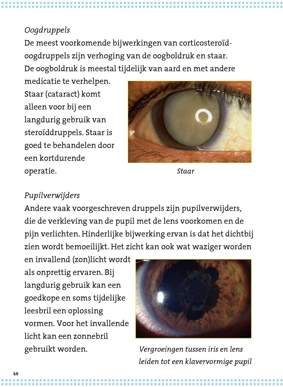 Staar Pupilverwijders Andere vaak voorgeschreven druppels zijn pupilverwijders, die de verkleving van de pupil met de lens voorkomen en de pijn verlichten.