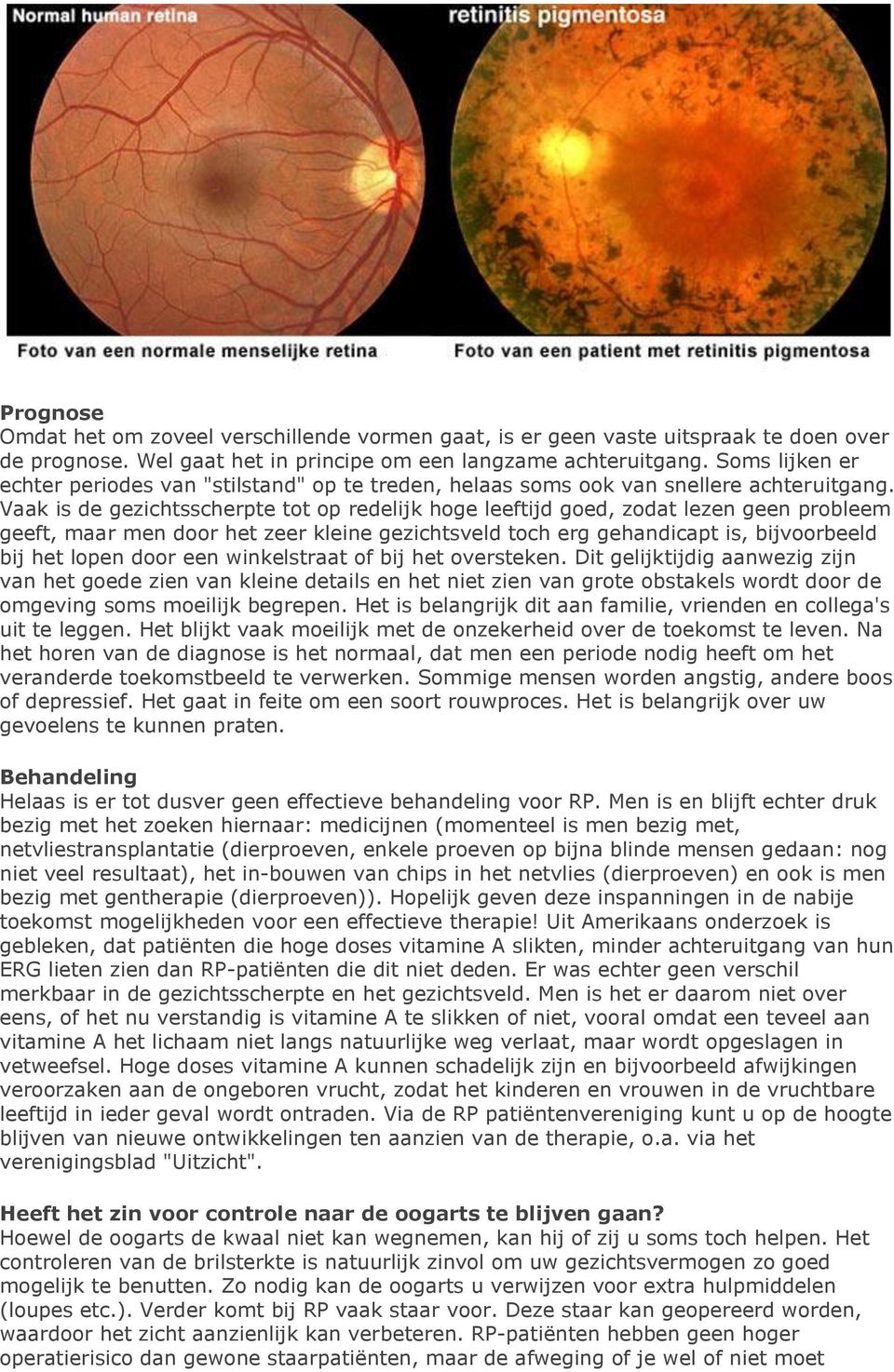 Vaak is de gezichtsscherpte tot op redelijk hoge leeftijd goed, zodat lezen geen probleem geeft, maar men door het zeer kleine gezichtsveld toch erg gehandicapt is, bijvoorbeeld bij het lopen door