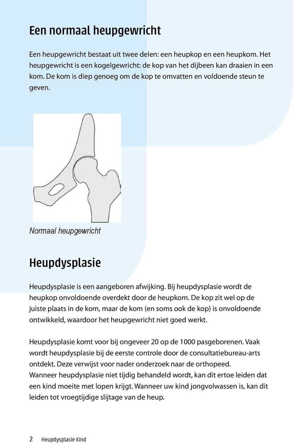 Bij heupdysplasie wordt de heupkop onvoldoende overdekt door de heupkom.