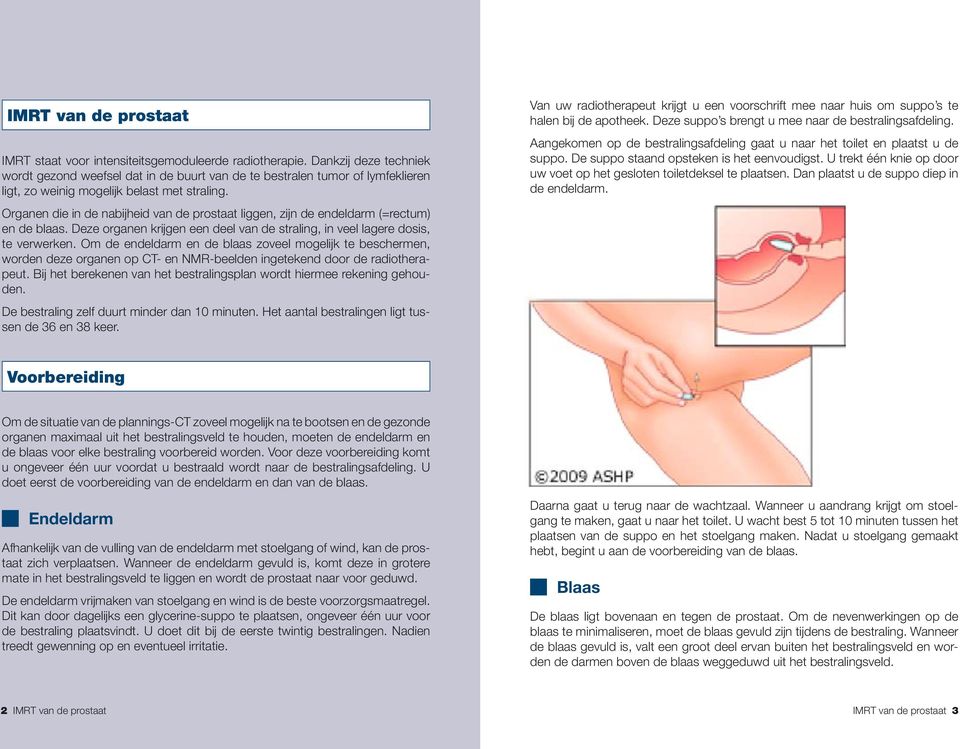 Organen die in de nabijheid van de prostaat liggen, zijn de endeldarm (=rectum) en de blaas. Deze organen krijgen een deel van de straling, in veel lagere dosis, te verwerken.