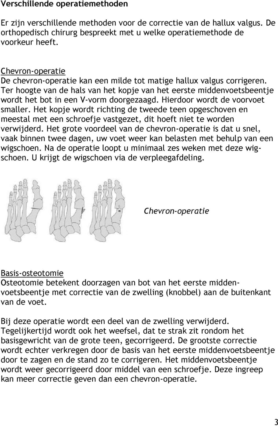 Hierdoor wordt de voorvoet smaller. Het kopje wordt richting de tweede teen opgeschoven en meestal met een schroefje vastgezet, dit hoeft niet te worden verwijderd.