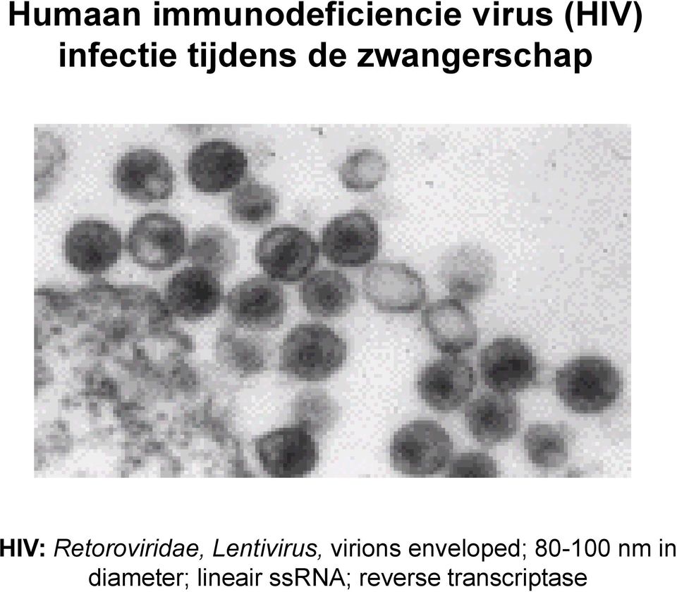 Retoroviridae, Lentivirus, virions