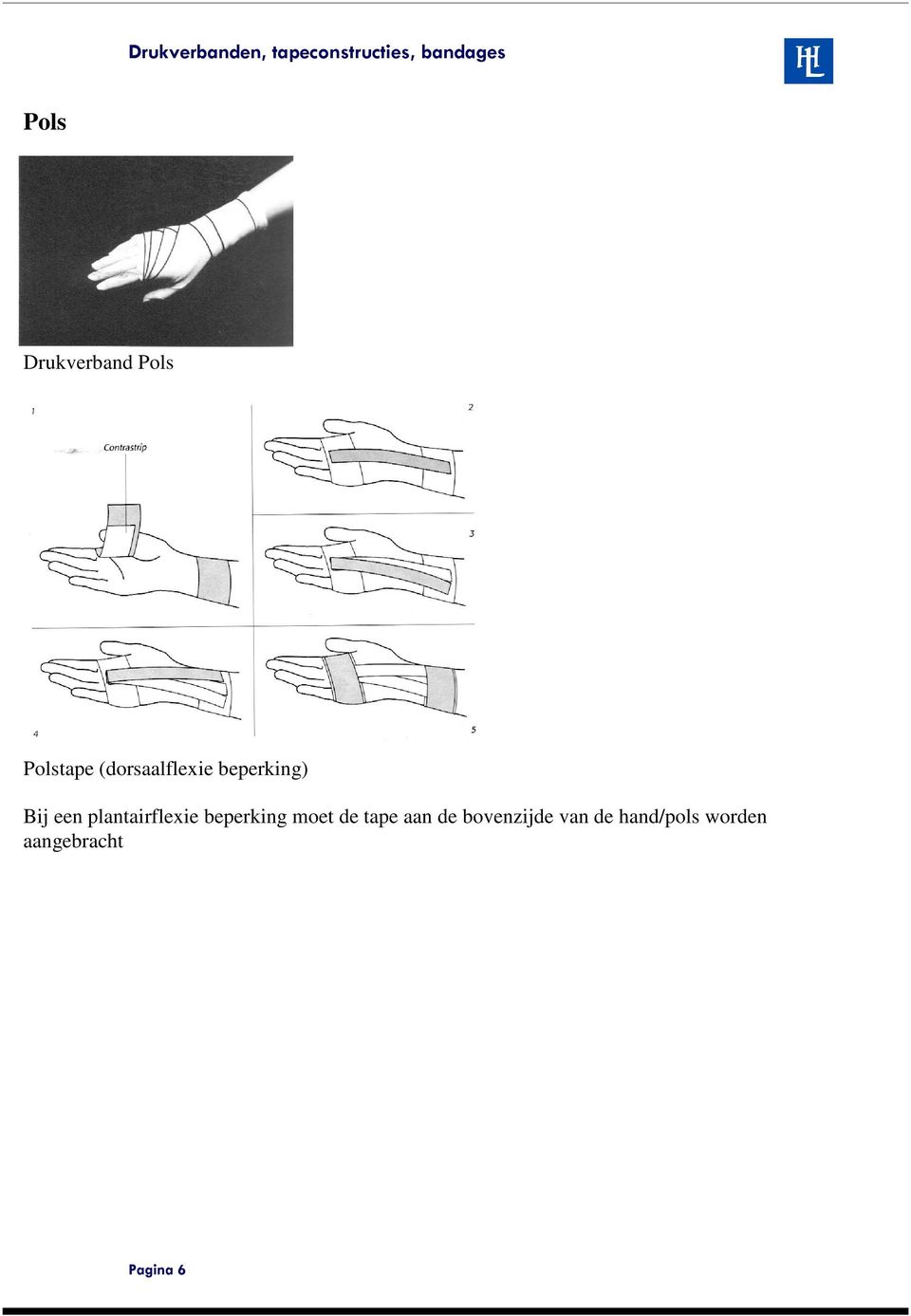 plantairflexie beperking moet de tape aan