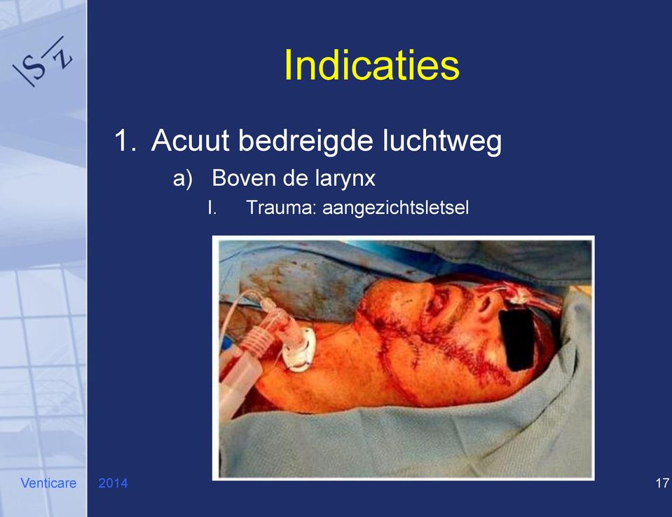 a) Boven de larynx I.