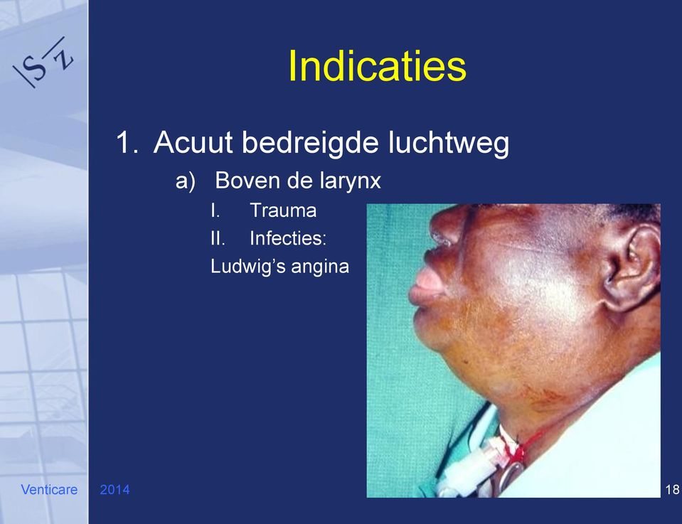 Boven de larynx I. Trauma II.