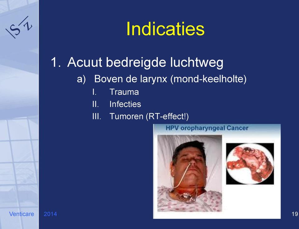 de larynx (mond-keelholte) I.