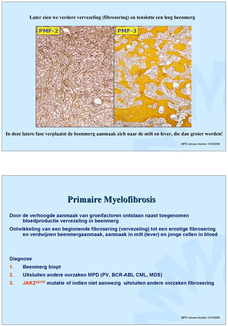 Primaire Myelofibrosis Door de verhoogde aanmaak van groeifactoren ontstaan naast toegenomen bloedproductie vervezeling in beenmerg Ontwikkeling van een