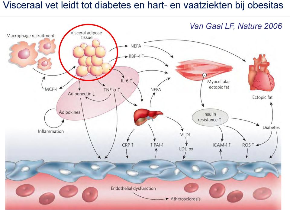 vaatziekten bij