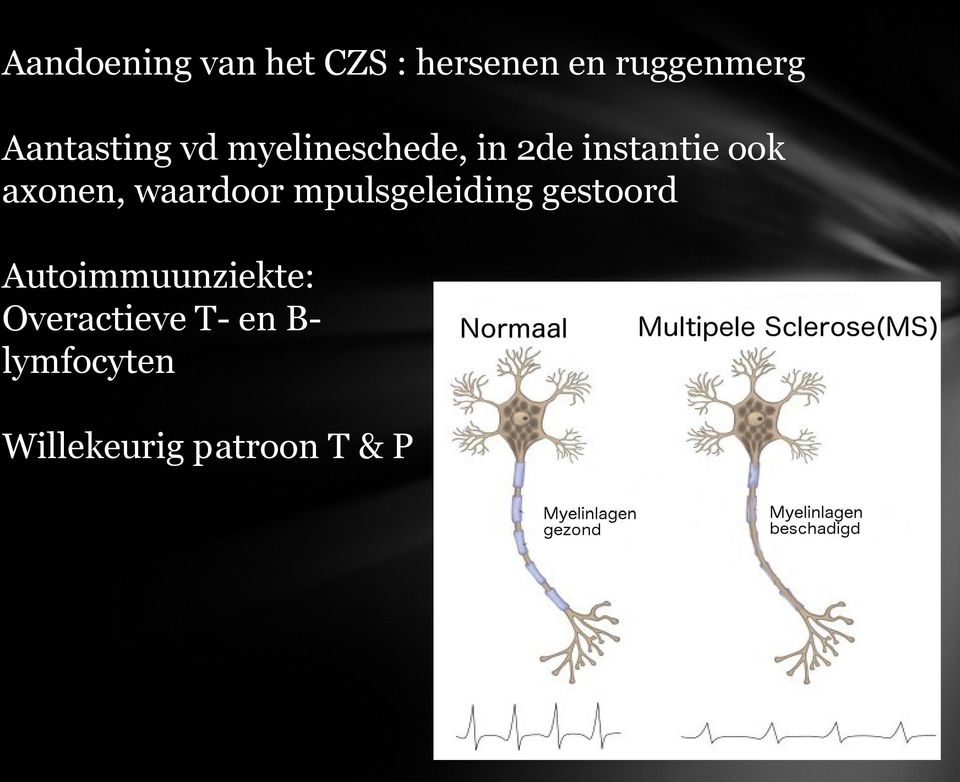 axonen, waardoor mpulsgeleiding gestoord