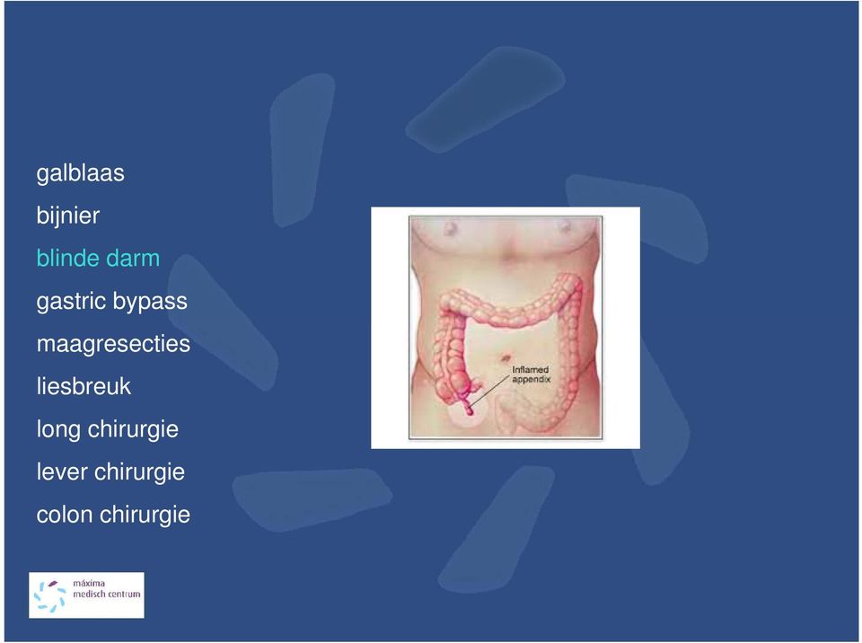 liesbreuk long chirurgie