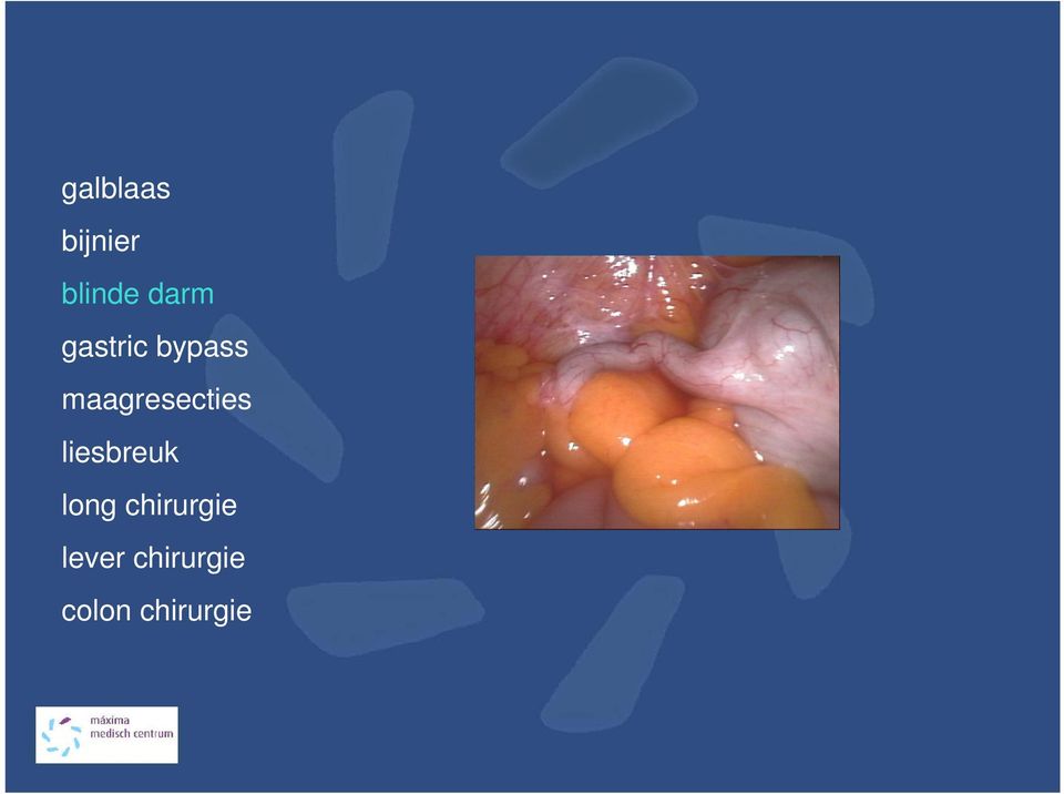 liesbreuk long chirurgie