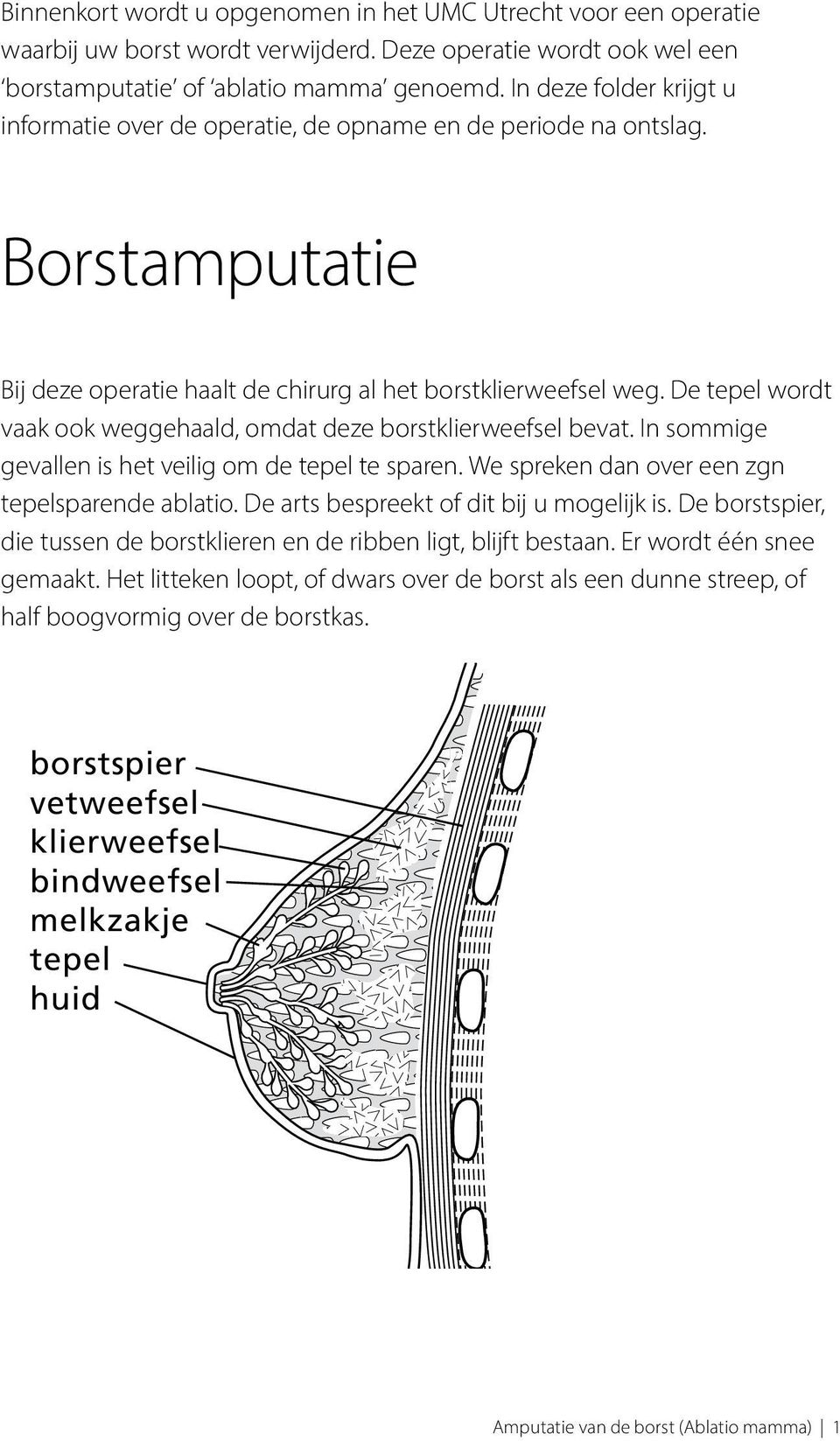 De tepel wordt vaak ook weggehaald, omdat deze borstklierweefsel bevat. In sommige gevallen is het veilig om de tepel te sparen. We spreken dan over een zgn tepelsparende ablatio.