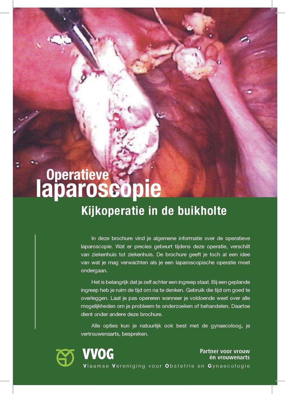 De brochure geeft je toch al een idee van wat je mag verwachten als je een laparoscopische operatie moet ondergaan. Het is belangrijk dat je zelf achter een ingreep staat.