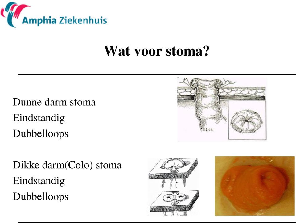 Eindstandig Dubbelloops