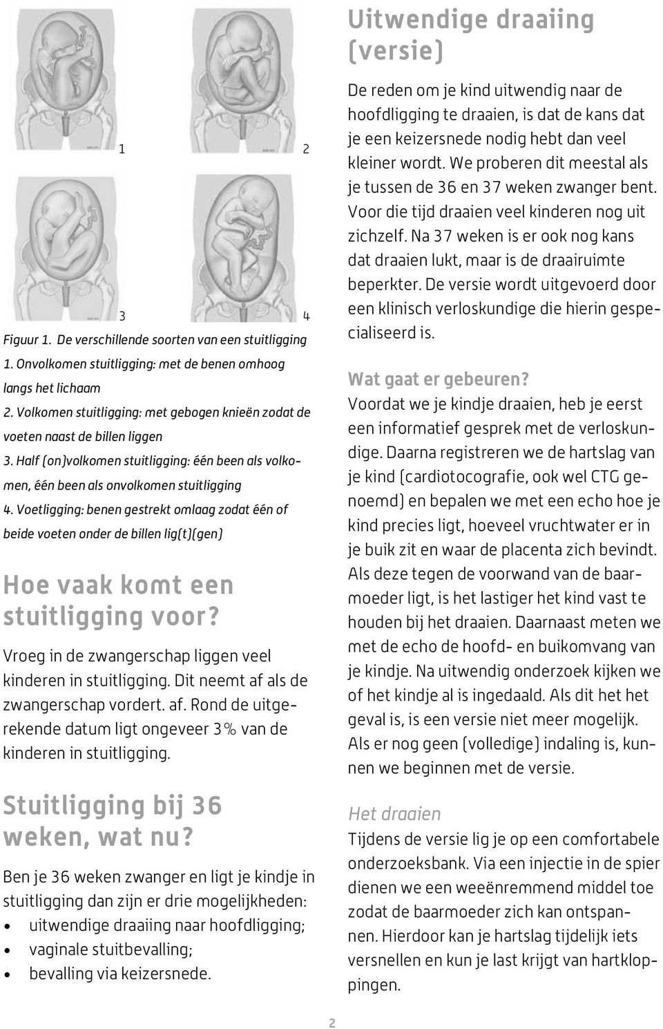 Voetligging: benen gestrekt omlaag zodat één of beide voeten onder de billen lig(t)(gen) Hoe vaak komt een stuitligging voor? Vroeg in de zwangerschap liggen veel kinderen in stuitligging.