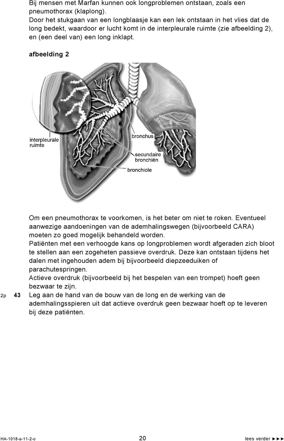 afbeelding 2 Om een pneumothorax te voorkomen, is het beter om niet te roken. Eventueel aanwezige aandoeningen van de ademhalingswegen (bijvoorbeeld CARA) moeten zo goed mogelijk behandeld worden.