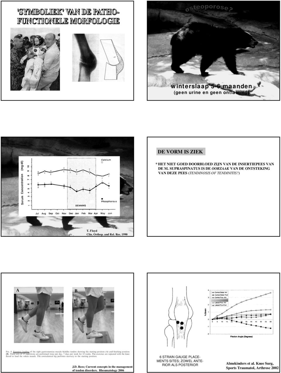 Floyd Clin. Orthop. and Rel. Res. 1990 A B J.D. Rees; Current concepts in the management of tendon disorders.