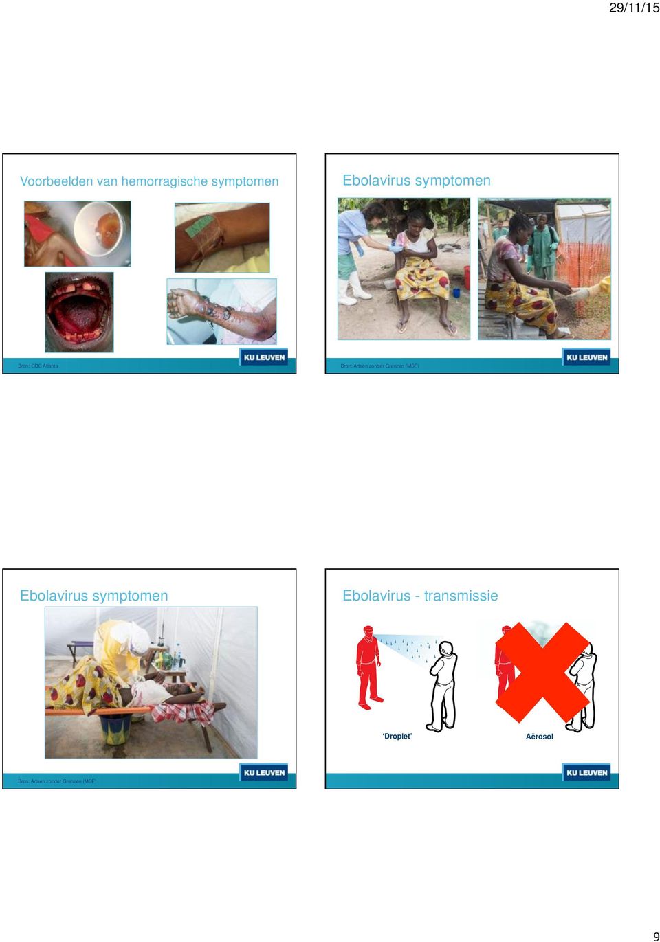 Grenzen (MSF) Ebolavirus symptomen Ebolavirus -