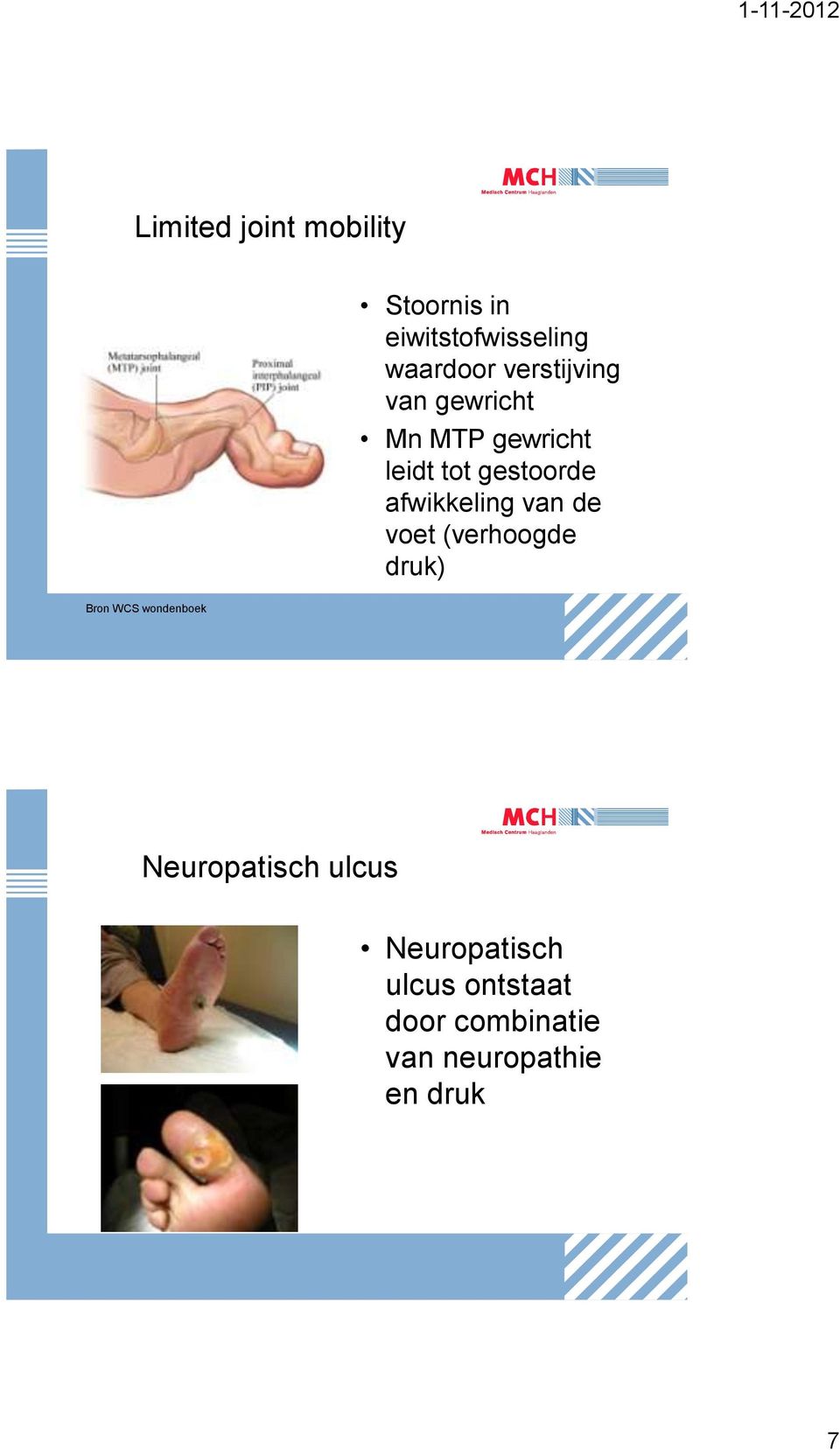 afwikkeling van de voet (verhoogde druk) Bron WCS wondenboek
