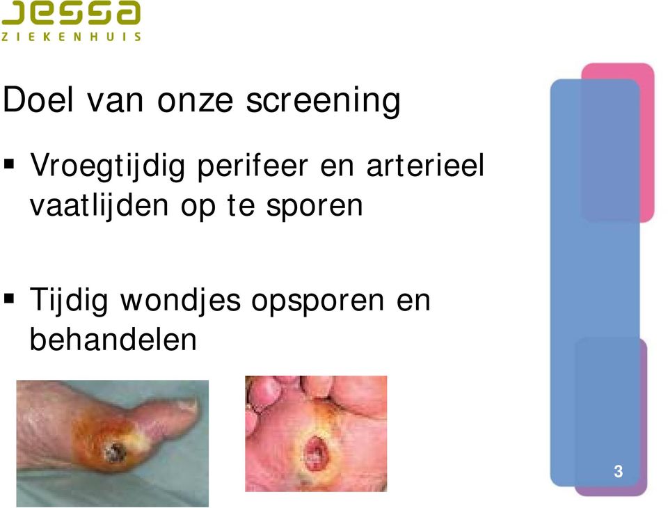 arterieel vaatlijden op te