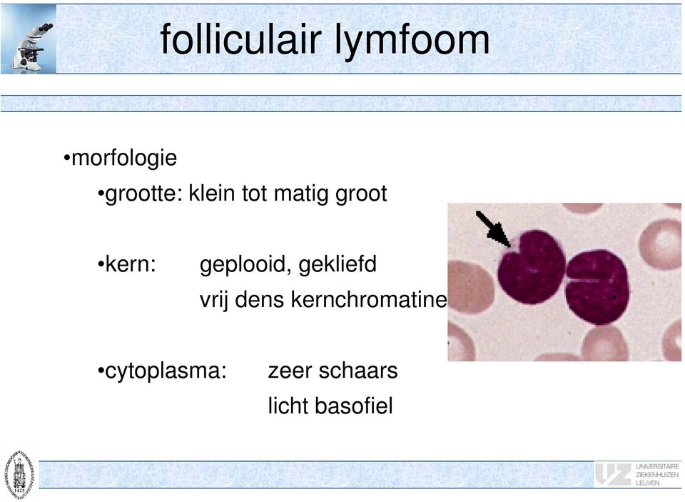 geplooid, gekliefd vrij dens