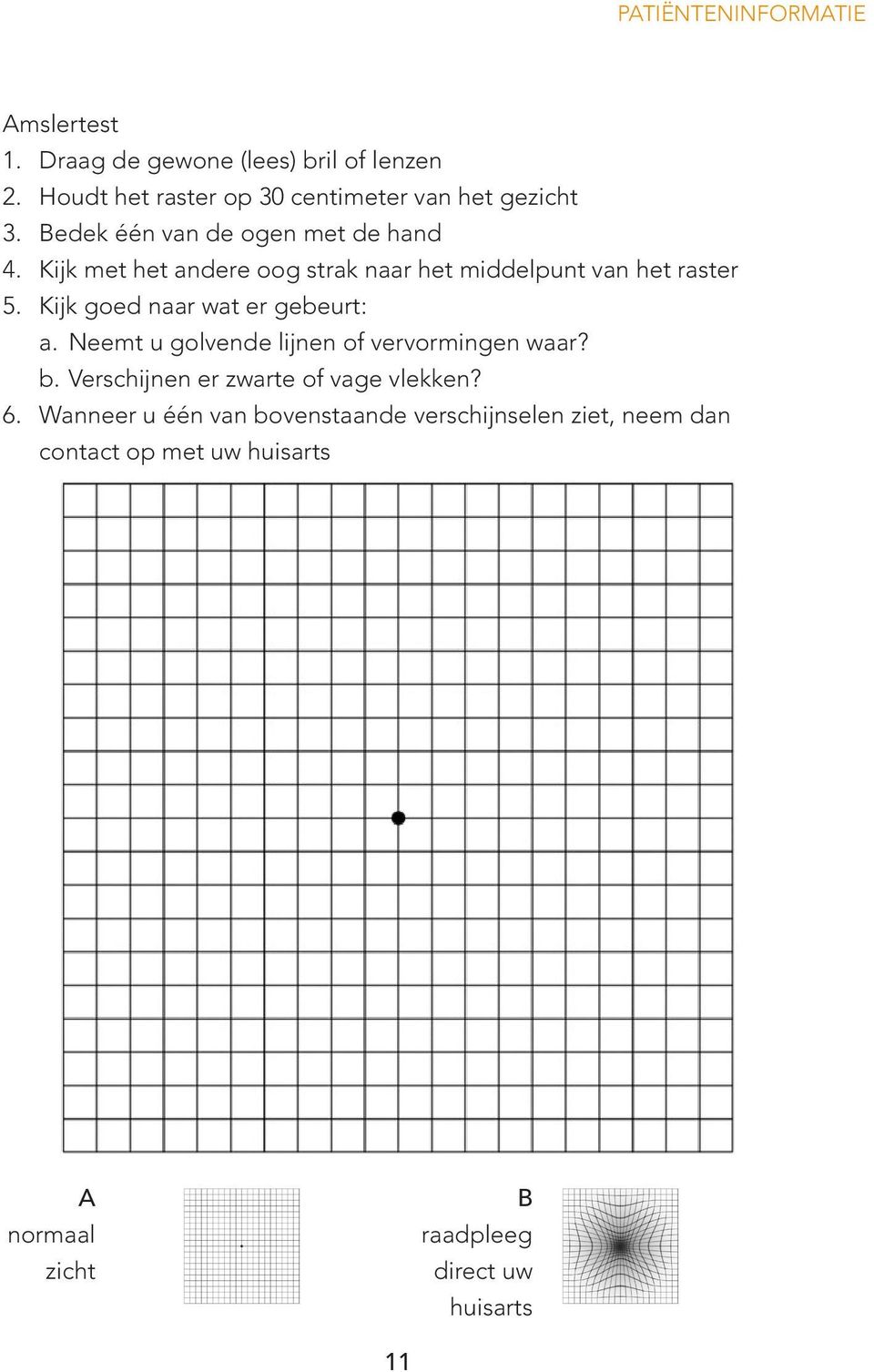 Kijk met het andere oog strak naar het middelpunt van het raster 5. Kijk goed naar wat er gebeurt: a.