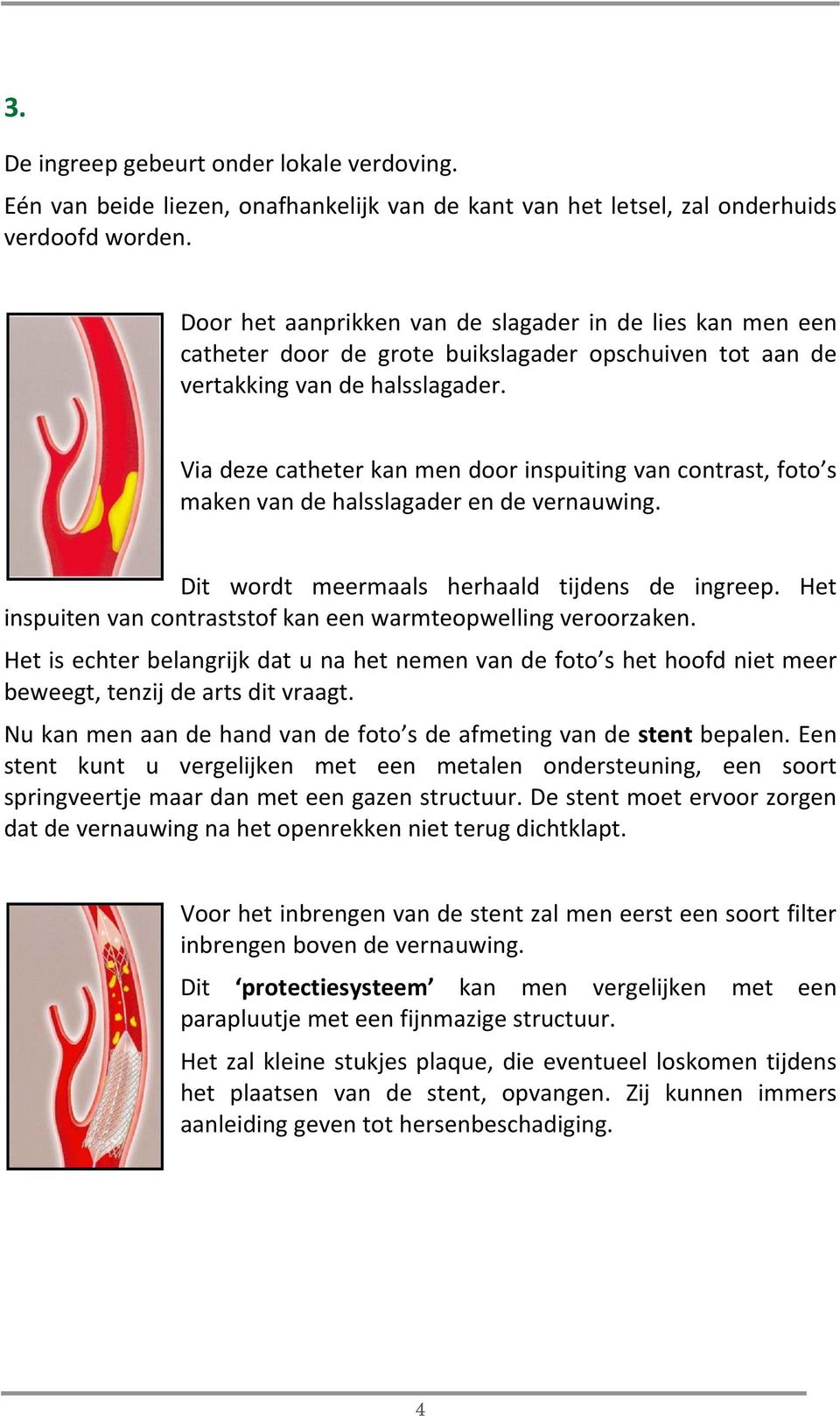 Via deze catheter kan men door inspuiting van contrast, foto s maken van de halsslagader en de vernauwing. Dit wordt meermaals herhaald tijdens de ingreep.