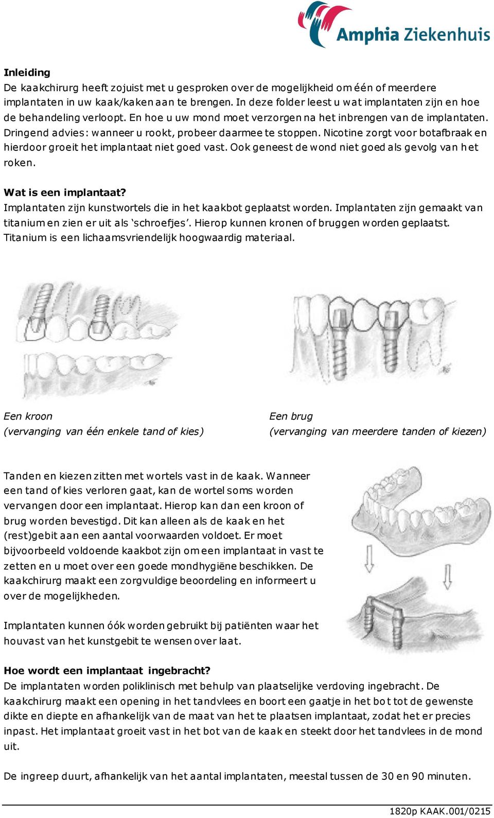 Dringend advies: wanneer u rookt, probeer daarmee te stoppen. Nicotine zorgt voor botafbraak en hierdoor groeit het implantaat niet goed vast. Ook geneest de wond niet goed als gevolg van h et roken.