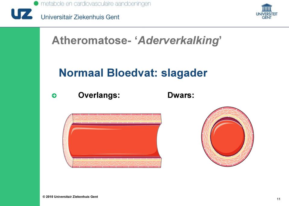 Normaal Bloedvat: