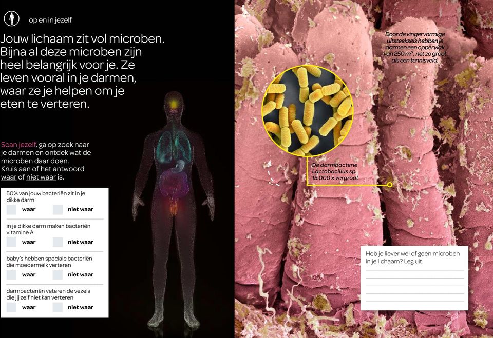 Kruis aan of het antwoord waar of niet waar is. De darmbacterie Lactobacillus sp. 15.