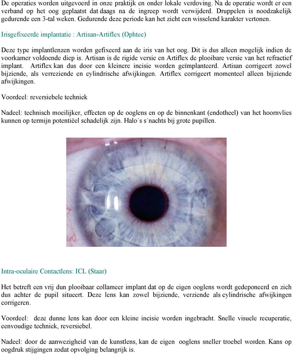 Irisgefixeerde implantatie : Artisan-Artiflex (Ophtec) Deze type implantlenzen worden gefixeerd aan de iris van het oog. Dit is dus alleen mogelijk indien de voorkamer voldoende diep is.