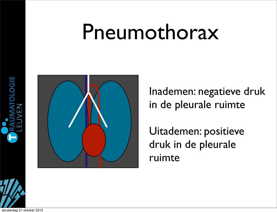 pleurale ruimte Uitademen: