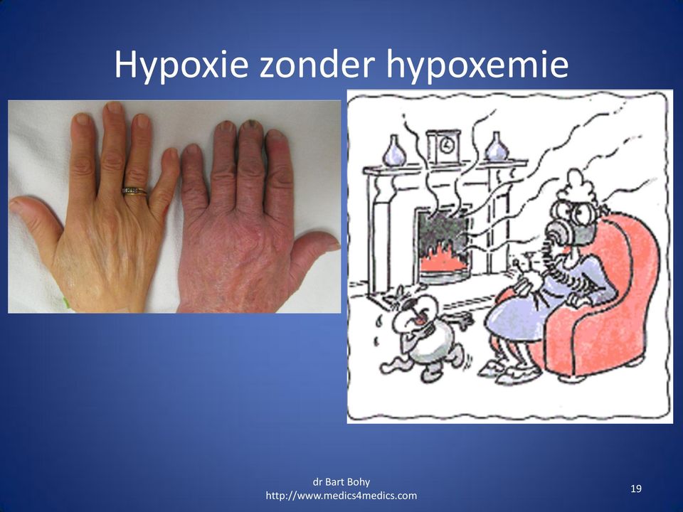 hypoxemie