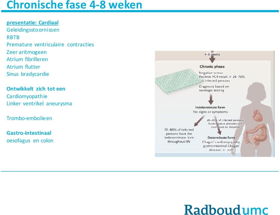 Atrium flutter Sinus bradycardie Ontwikkelt zich tot een Cardiomyopathie