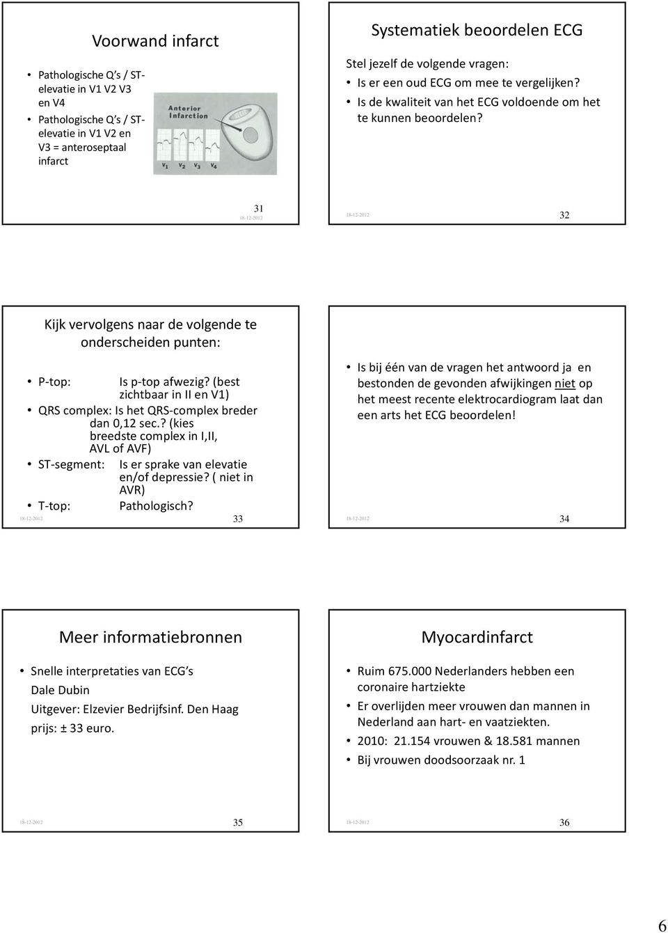 (best zichtbaar in II en V1) QRS complex: Is het QRS complex breder dan 0,12 sec.? (kies breedste complex in I,II, AVL of AVF) ST segment: T top: Is er sprake van elevatie en/of depressie?