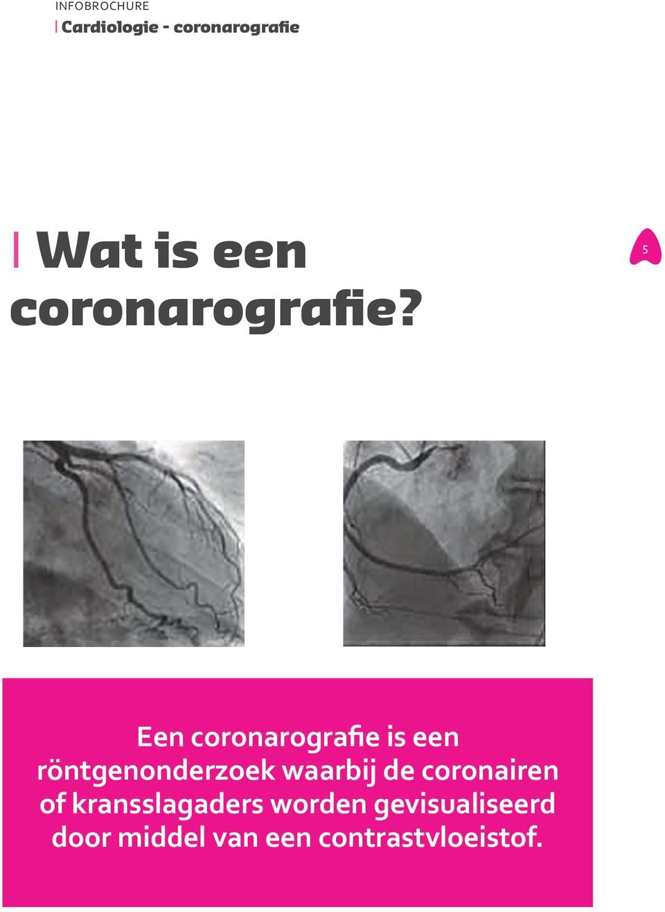 5 Een coronarografie is een röntgenonderzoek waarbij