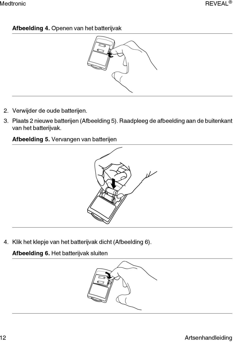 Raadpleeg de afbeelding aan de buitenkant van het batterijvak. Afbeelding 5.