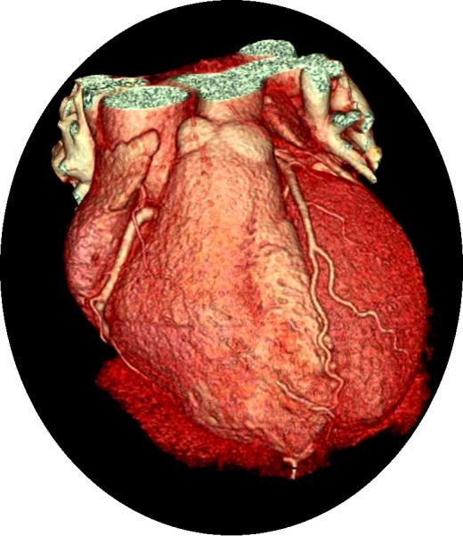 patiënteninformatie medische beeldvorming Cardiaal CT-onderzoek