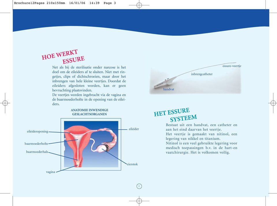De veertjes worden ingebracht via de vagina en de baarmoederholte in de opening van de eileiders.