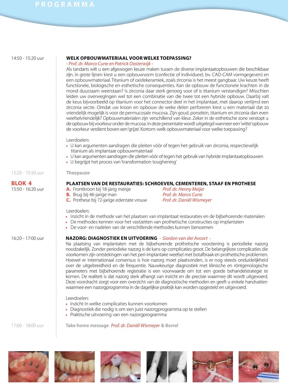 In grote ijnen kiest u een opbouwvorm (confectie of individuee, bv. CAD-CAM vormgegeven) en een opbouwmateriaa. Titanium of oxidekeramiek, zoas zirconia is het meest gangbaar.