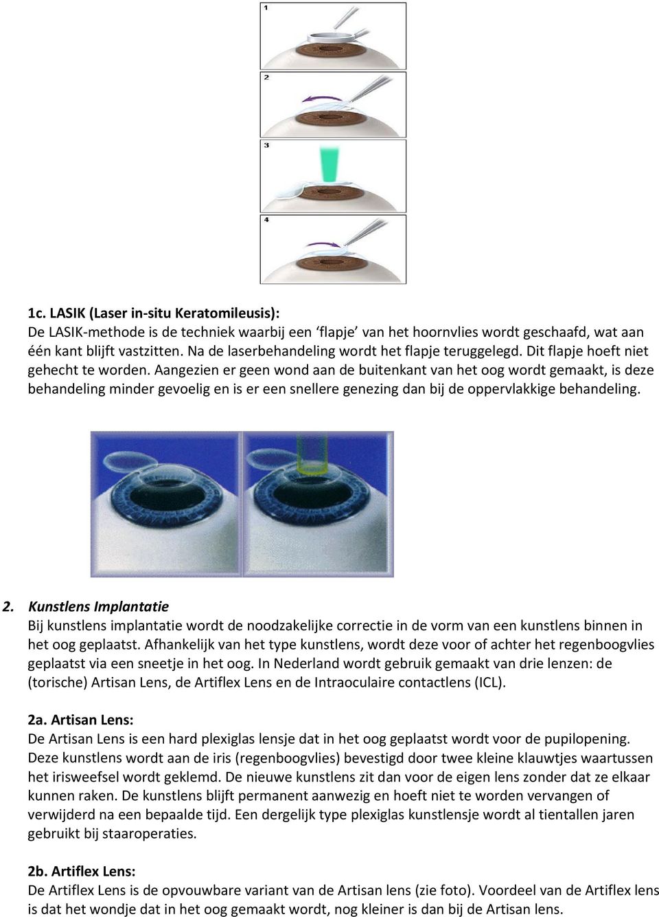 Aangezien er geen wond aan de buitenkant van het oog wordt gemaakt, is deze behandeling minder gevoelig en is er een snellere genezing dan bij de oppervlakkige behandeling. 2.